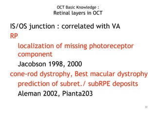 IS/OS junction : correlated with VA
RP
localization of missing photoreceptor
component
Jacobson 1998, 2000
cone-rod dystrophy, Best macular dystrophy
prediction of subret./ subRPE deposits
Aleman 2002, Pianta203
30
OCT Basic Knowledge :
Retinal layers in OCT
 