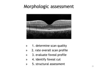 Morphologic assessment
» 1. determine scan quality
» 2. rate overall scan profile
» 3. evaluate foveal profile
» 4. identify foveal cut
» 5. structural assessment
33
 