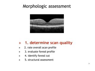 Morphologic assessment
» 1. determine scan quality
» 2. rate overall acan profile
» 3. evaluate foveal profile
» 4. identify foveal cut
» 5. structural assessment
34
 