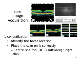 back to
Image
Acquisition
1. centralization
• Identify the fovea location
• Place the scan on it correctly
– Centre line tool(OCT3 software) : right
click
45
 