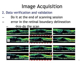 Image Acquisition
2. Data verification and validation
– Do it at the end of scanning session
– error in the retinal boundary delineation
– re-do the scan
6
 