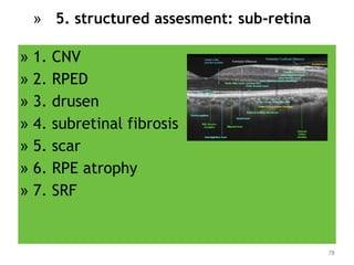 » 1. CNV
» 2. RPED
» 3. drusen
» 4. subretinal fibrosis
» 5. scar
» 6. RPE atrophy
» 7. SRF
78
» 5. structured assesment: sub-retina
 