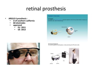 retinal prosthesis
• ARGUS II prosthesis :
• U of southern california
• 60 electrodes
• approved
• EU 2011
• US 2013
 