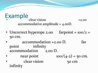 Example clear vision


+2.00

accommodative amplitude = 4.00D.

• Uncorrect hyperope 2.00 farpoint = 100/2 =
50 cm.
•
accommodation +2.00 D.
far
point
infinity
accommodation
2.00 D.
•
near point
100/(4-2) = 50 cm.
•
clear vision
50 cm
infinity

 
