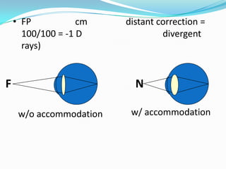 • FP
cm
100/100 = -1 D
rays)

F

distant correction =
divergent

N
w/o accommodation

w/ accommodation

 