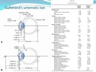 Gullstrand’s schematic eye

 