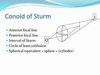 Conoid of Sturm
 Anterior focal line
 Posterior focal line

 Interval of Sturm

O

 Circle of least confusion
 Spherical equivalent = sphere + (cylinder/

I

 