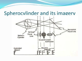 Spherocylinder and its imagery

 