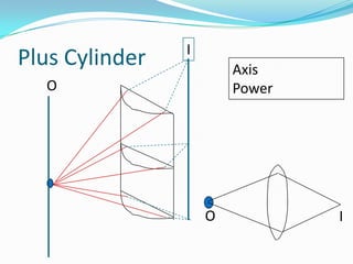 Plus Cylinder

I
Axis
Power

O

O

I

 