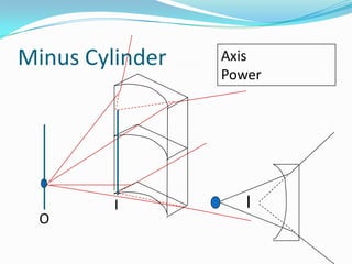 Minus Cylinder

O

I

Axis
Power

I

 
