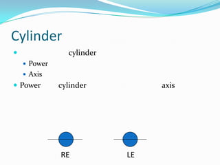 Cylinder


cylinder
 Power
 Axis

 Power

cylinder

RE

axis

LE

 