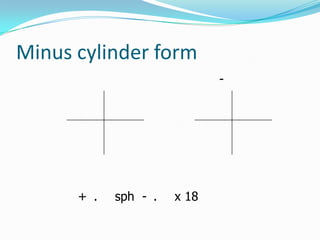 Minus cylinder form
-

+ .

sph - .

x 18

 
