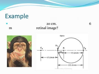 Example


m

20 cm.
retinal image?

6

 