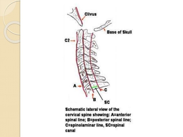 Cd Spine Example Cervical_Spine.pptx