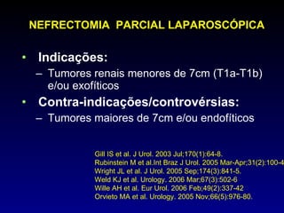 Indicações: T umores renais menores de 7cm (T1a-T1b) e/ou exofíticos Contra-indicações/controvérsias: Tumores maiores de 7cm e/ou endofíticos NEFRECTOMIA  PARCIAL LAPAROSCÓPICA Gill IS et al . J Urol. 2003 Jul;170(1):64-8.  Rubinstein M et al.Int Braz J Urol. 2005 Mar-Apr;31(2):100-4.  Wright JL et al. J Urol. 2005 Sep;174(3):841-5. Weld KJ et al. Urology. 2006 Mar;67(3):502-6 Wille AH et al.  Eur Urol. 2006 Feb;49(2):337-42 Orvieto MA et al. Urology. 2005 Nov;66(5):976-80.  