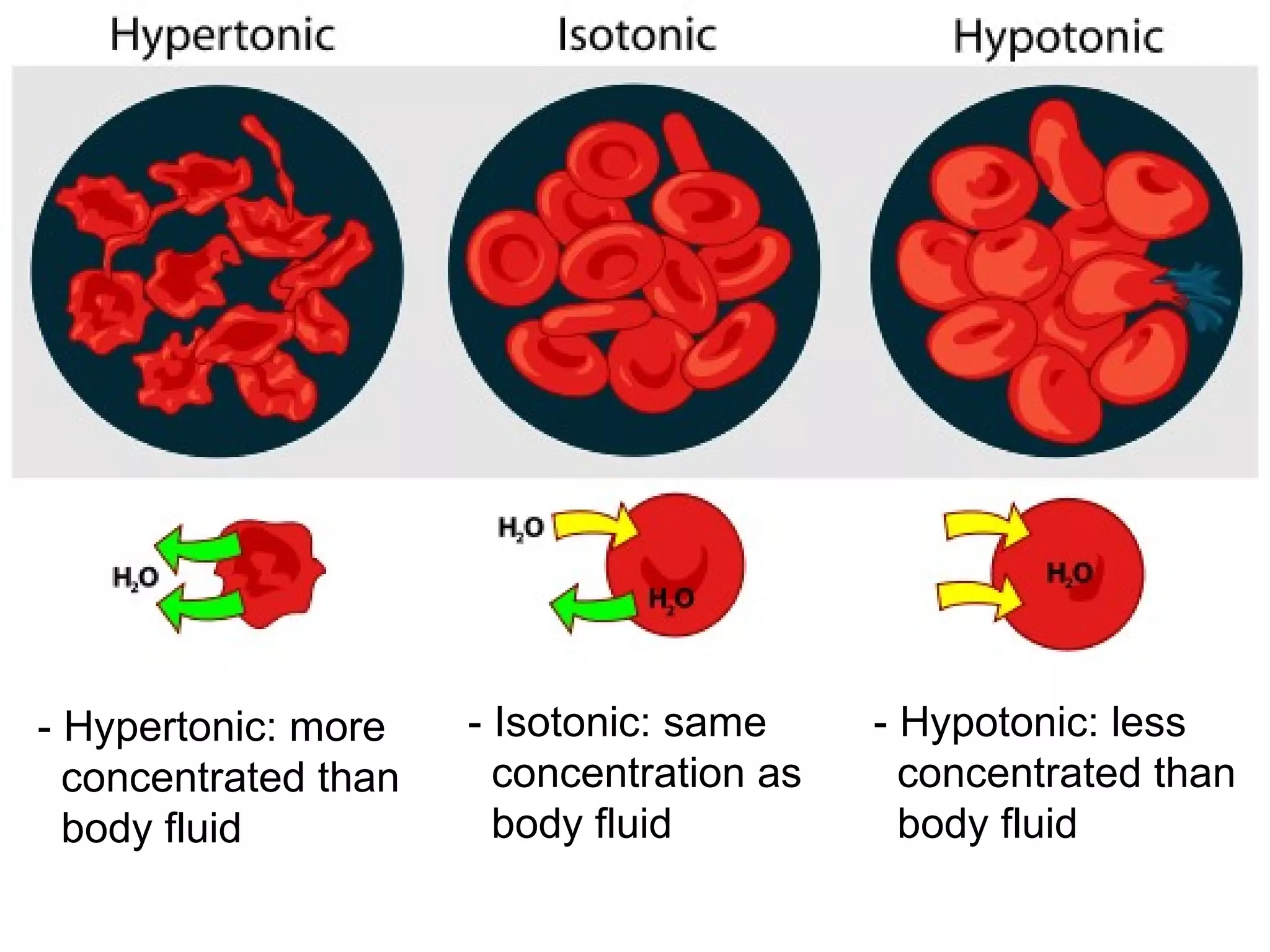 - Isotonic: same concentration as body fluid - Hypertonic: more concentrated than body fluid - Hypotonic: less concentrated than body fluid 