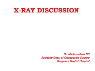 X-RAY DISCUSSION 
Dr. Madhusudhan NC 
Resident-Dept. of Orthopaedic Surgery 
Bangalore Baptist Hospital 
 