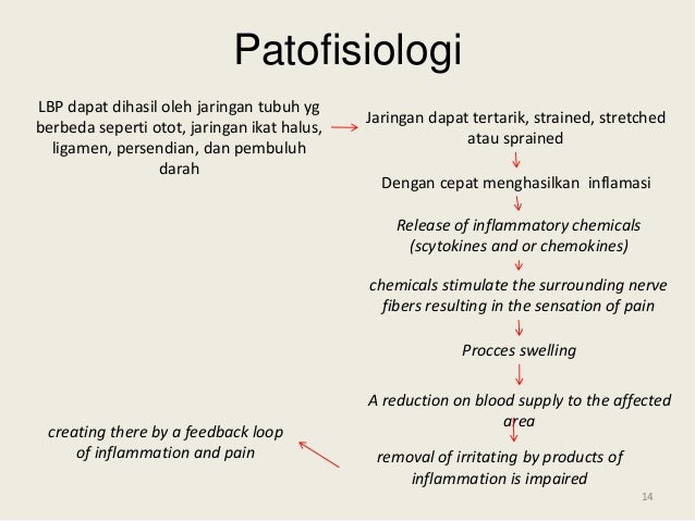Nyeri Pinggang Bawah