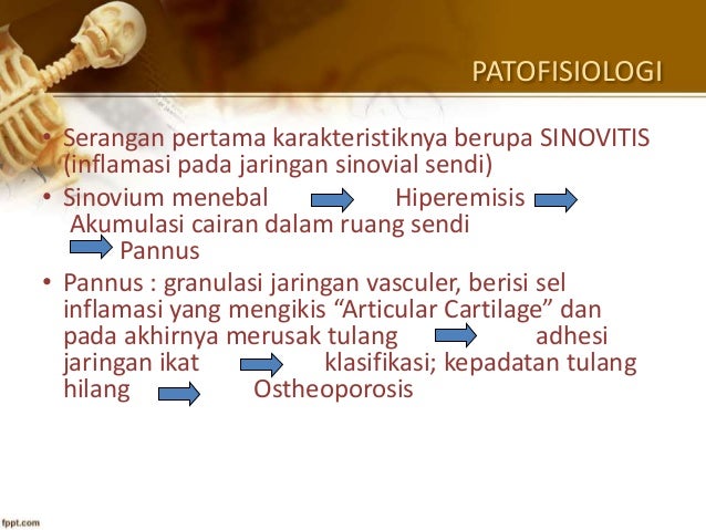 Nyeri Sendi Nyeri Sendi