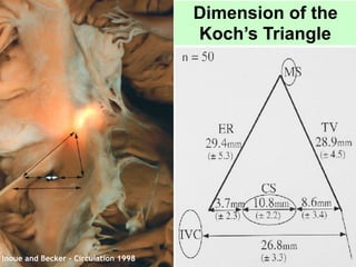 Triangle Becker Anatomia e Fisiologia do Sistema Elétrico do Coração - por Dr. André D ...