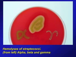 Hemolyses of streptococci.
(from left) Alpha, beta and gamma
 