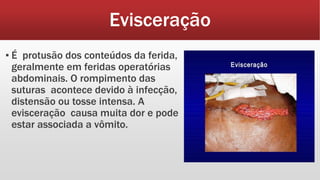 Evisceração
▪ É protusão dos conteúdos da ferida,
geralmente em feridas operatórias
abdominais. O rompimento das
suturas acontece devido à infecção,
distensão ou tosse intensa. A
evisceração causa muita dor e pode
estar associada a vômito.
 