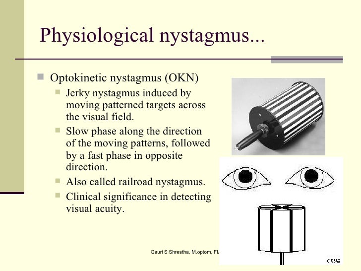 nystagmus nystagmus, Skeleton