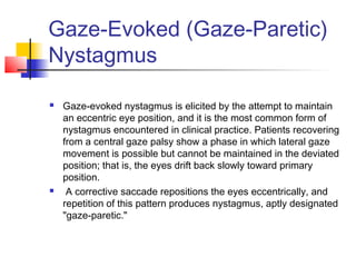 Gaze-Evoked (Gaze-Paretic)
Nystagmus
 Gaze-evoked nystagmus is elicited by the attempt to maintain
an eccentric eye position, and it is the most common form of
nystagmus encountered in clinical practice. Patients recovering
from a central gaze palsy show a phase in which lateral gaze
movement is possible but cannot be maintained in the deviated
position; that is, the eyes drift back slowly toward primary
position.
 A corrective saccade repositions the eyes eccentrically, and
repetition of this pattern produces nystagmus, aptly designated
"gaze-paretic."
 