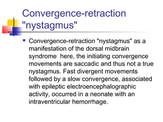 Convergence-retraction
"nystagmus"
 Convergence-retraction "nystagmus" as a
manifestation of the dorsal midbrain
syndrome here, the initiating convergence
movements are saccadic and thus not a true
nystagmus. Fast divergent movements
followed by a slow convergence, associated
with epileptic electroencephalographic
activity, occurred in a neonate with an
intraventricular hemorrhage.
 
