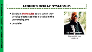 • occurs in monocular adults when they
develop decreased visual acuity in the
only seeing eye
• pendular
ACQUIRED OCULAR NYSTAGMUS
SENSORYDEPRIVATION(OCULAR)NYSTAGMUS
Director Nick Fury
S.H.I.E.L.D.
 