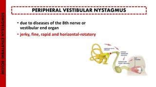 • due to diseases of the 8th nerve or
vestibular end organ
• jerky, fine, rapid and horizontal-rotatory
PERIPHERAL VESTIBULAR NYSTAGMUS
MOTORIMBALANCENYSTAGMUS
 