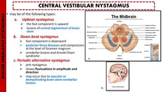 • may be of the following types:
a. Upbeat nystagmus
 the fast component is upward
 lesions of central tegmentum of brain
stem
b. Down beat nystagmus
 fast component is downward
 posterior fossa diseases and compression
at the level of foramen magnum
 cerebellar lesions and Arnold Chiari
syndrome.
c. Periodic alternative nystagmus
 jerk nystagmus
 shows fluctuations in amplitude and
direction
 may occur due to vascular or
demyelinating brain stem-cerebellar
lesions
CENTRAL VESTIBULAR NYSTAGMUS
MOTORIMBALANCENYSTAGMUS
a.
b.
 