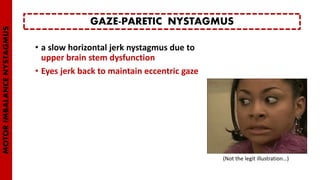 • a slow horizontal jerk nystagmus due to
upper brain stem dysfunction
• Eyes jerk back to maintain eccentric gaze
GAZE-PARETIC NYSTAGMUS
MOTORIMBALANCENYSTAGMUS
(Not the legit illustration…)
 