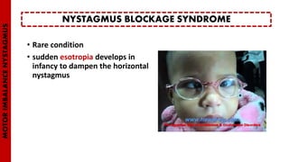 • Rare condition
• sudden esotropia develops in
infancy to dampen the horizontal
nystagmus
NYSTAGMUS BLOCKAGE SYNDROME
MOTORIMBALANCENYSTAGMUS
 
