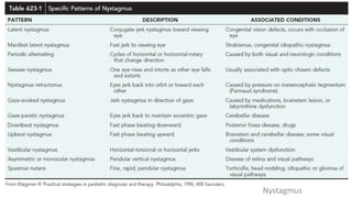 Nystagmus
 