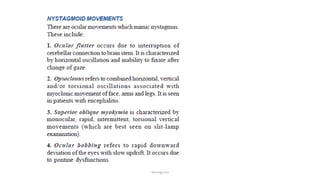 Nystagmus
 