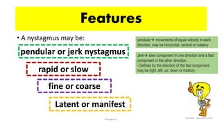 • A nystagmus may be:
Nystagmus
Features
pendular or jerk nystagmus
rapid or slow
fine or coarse
Latent or manifest
pendular movements of equal velocity in each
direction; may be horizontal, vertical or rotatory
Jerk slow component in one direction and a fast
component in the other direction.
- Defined by the direction of the fast component;
may be right, left, up, down or rotatory.
 