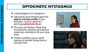  a physiological jerk nystagmus
 induced by presenting to gaze the
objects moving serially in one
direction, such as strips of a
spinning optokinetic drum
 The eyes will follow a fixed strip
momentarily and then jerk back to
reposition centrally to fix up a new
strip.
 Similar condition occurs while
looking at outside things from a
moving train.
OPTOKINETIC NYSTAGMUS
PHYSIOLOGICALNYSTAGMUS
 