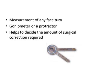 • Measurement of any face turn
• Goniometer or a protractor
• Helps to decide the amount of surgical
correction required
 