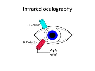 Infrared oculography
 