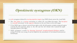 Optokinetic nystagmus (OKN)
is a jerk nystagmus induced by moving repetitive targets (e.g. OKN drum) across the visual field.
• The slow phase is a pursuit movement in which the eyes follow the target. The fast phase
is a saccadic movement in the opposite direction as the eyes fixate on the next target.
• If the OKN tape or drum is moved from right to left, the left parieto-occipito-temporal region
controls the slow (pursuit) phase to the left and the left frontal lobe controls the rapid
(saccadic) phase to the right.
• OKN nystagmus is useful for detecting functional (nonphysiological) blindness and for
testing VA in the very young. It can be helpful in the assessment of an isolated homonymous
hemianopia.
 