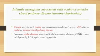 Infantile nystagmus associated with ocular or anterior
visual pathway disease (sensory deprivation)
• Erratic waveform ± roving eye movements; moderate/ severe dVA due to
ocular or anterior visual pathway disease.
• Common ocular diseases associated include: cataract, albinism, CSNB, cone–
rod dystrophy, LCA, optic nerve hypoplasia.
 
