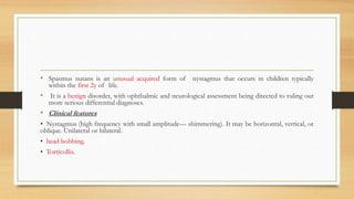 • Spasmus nutans is an unusual acquired form of nystagmus that occurs in children typically
within the first 2y of life.
• It is a benign disorder, with ophthalmic and neurological assessment being directed to ruling out
more serious differential diagnoses.
• Clinical features
• Nystagmus (high frequency with small amplitude— shimmering). It may be horizontal, vertical, or
oblique. Unilateral or bilateral.
• head bobbing.
• Torticollis.
 
