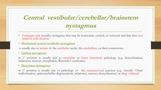 Central vestibular/cerebellar/brainstem
nystagmus
• Conjugate jerk (usually) nystagmus that may be horizontal, vertical, or torsional and that does not
improve with fixation.
• Horizontal central vestibular nystagmus
is usually due to lesions of the vestibular nuclei, the cerebellum, or their connections.
• Upbeat nystagmus
in 1° position is usually due to cerebellar or lower brainstem pathology (e.g. demyelination,
infarction, tumour, encephalitis, Wernicke’s syndrome).
• Downbeat nystagmus
in 1° position is usually due to pathology of the craniocervical junction (e.g. Arnold– Chiari
malformation, spinocerebellar degenerations, infarction, tumour, demyelination) or drug- induced.
 