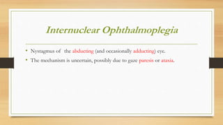 Internuclear Ophthalmoplegia
• Nystagmus of the abducting (and occasionally adducting) eye.
• The mechanism is uncertain, possibly due to gaze paresis or ataxia.
 