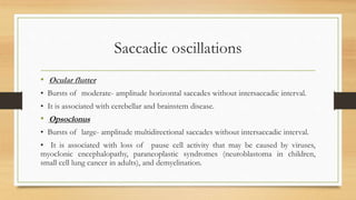 Saccadic oscillations
• Ocular flutter
• Bursts of moderate- amplitude horizontal saccades without intersaccadic interval.
• It is associated with cerebellar and brainstem disease.
• Opsoclonus
• Bursts of large- amplitude multidirectional saccades without intersaccadic interval.
• It is associated with loss of pause cell activity that may be caused by viruses,
myoclonic encephalopathy, paraneoplastic syndromes (neuroblastoma in children,
small cell lung cancer in adults), and demyelination.
 