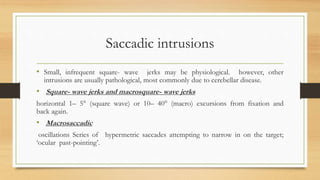 Saccadic intrusions
• Small, infrequent square- wave jerks may be physiological. however, other
intrusions are usually pathological, most commonly due to cerebellar disease.
• Square- wave jerks and macrosquare- wave jerks
horizontal 1– 5° (square wave) or 10– 40° (macro) excursions from fixation and
back again.
• Macrosaccadic
oscillations Series of hypermetric saccades attempting to narrow in on the target;
‘ocular past-pointing’.
 