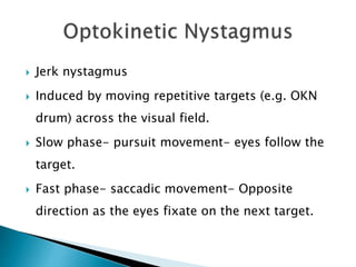  Jerk nystagmus
 Induced by moving repetitive targets (e.g. OKN
drum) across the visual field.
 Slow phase- pursuit movement- eyes follow the
target.
 Fast phase- saccadic movement- Opposite
direction as the eyes fixate on the next target.
 