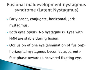 Early onset, conjugate, horizontal, jerk
nystagmus.
 Both eyes open> No nystagmus> Eyes with
FMN are stable during fusion.
 Occlusion of one eye (elimination of fusion)>
horizontal nystagmus becomes apparent>
fast phase towards uncovered fixating eye.
 