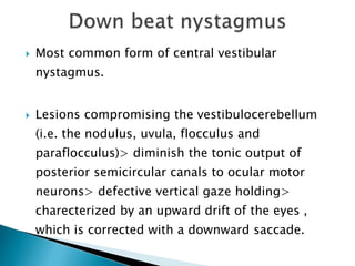  Most common form of central vestibular
nystagmus.
 Lesions compromising the vestibulocerebellum
(i.e. the nodulus, uvula, flocculus and
paraflocculus)> diminish the tonic output of
posterior semicircular canals to ocular motor
neurons> defective vertical gaze holding>
charecterized by an upward drift of the eyes ,
which is corrected with a downward saccade.
 